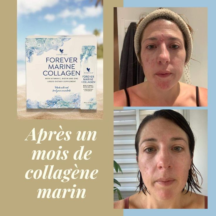 Collagène marin – Image 7