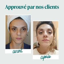 Collagène marin – Image 11