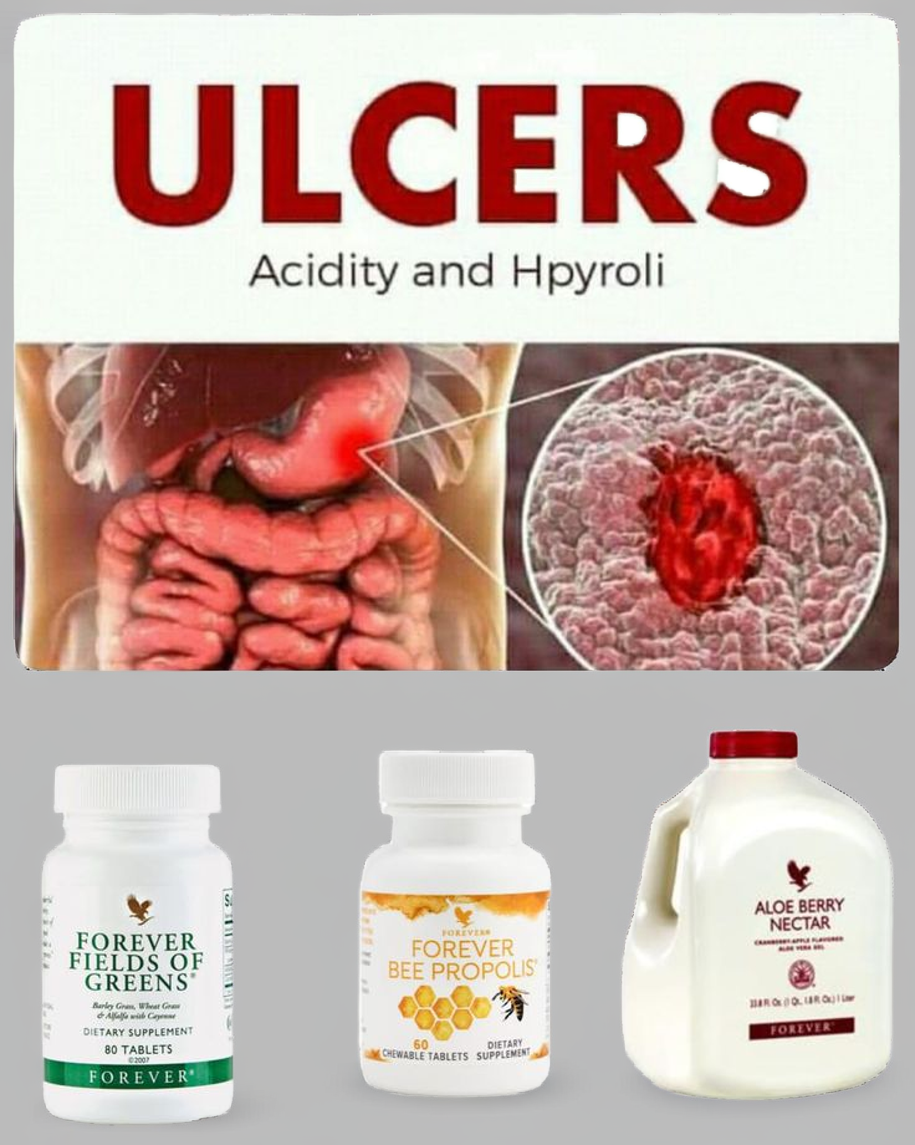 Kit pour un soulagement naturel ulcère