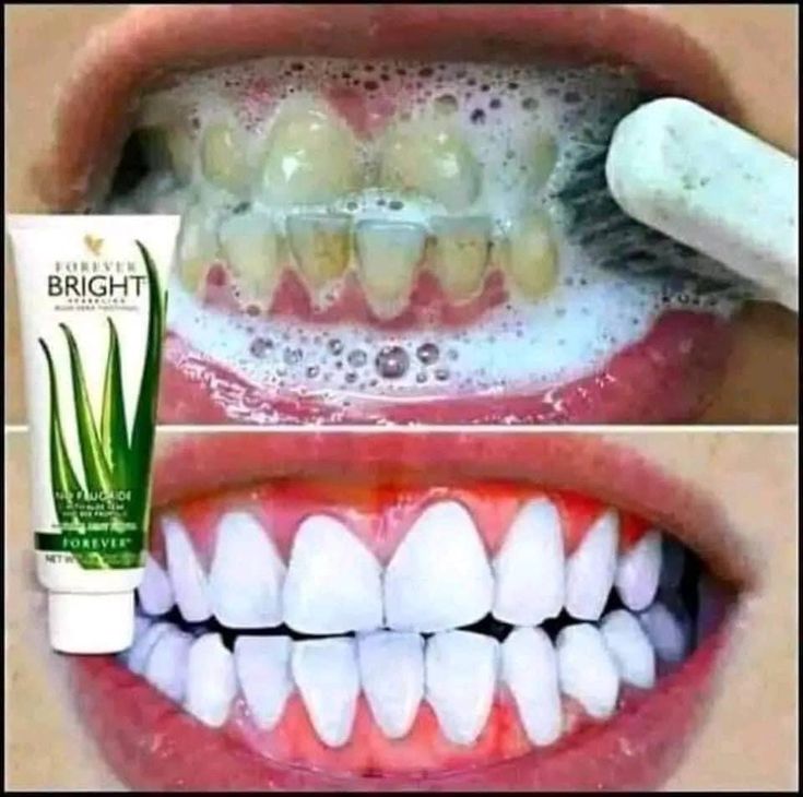 Forever Bright - Gel Dentaire Blanchissant et Rafraîchissant pour un Sourire Éclatant