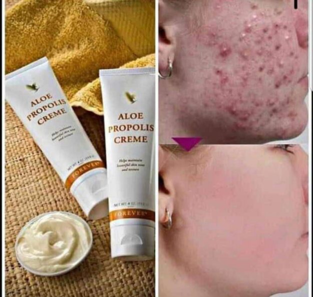Aloe propolis creme