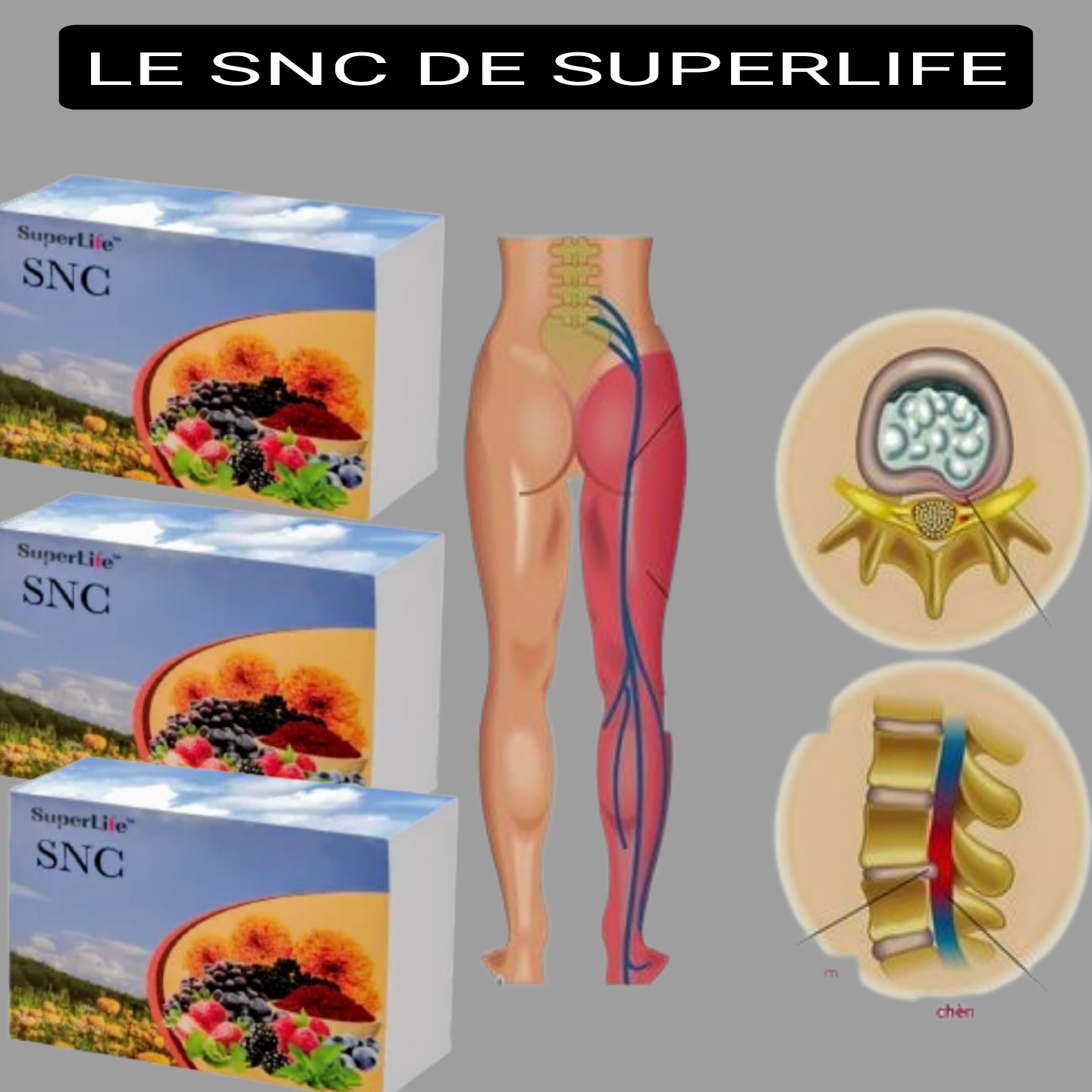 LE SNC DE SUPERLIFE
